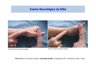 Exame Neurológico da Mão
Fonte: Mattar Jr.,R; Azze,RJ; Falcetti,J; Semiologia da Mão – Publicação do IOT – Famed USP , Searle - Phizer
 