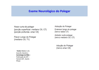 Flexor curto do polegar
Exame Neurológico do Polegar
Fonte: Mattar Jr.,R;
Azze,RJ; Falcetti,J;
Semiologia da Mão –
Publicação do IOT –
Famed USP , Searle -
Phizer
 