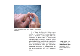 Fonte: Mattar Jr.,R;
Azze,RJ; Falcetti,J;
Semiologia da Mão –
Publicação do IOT –
Famed USP , Searle -
Phizer
 