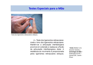 Testes Especiais para a Mão
Fonte: Mattar Jr.,R;
Azze,RJ; Falcetti,J;
Semiologia da Mão –
Publicação do IOT –
Famed USP , Searle -
Phizer
 