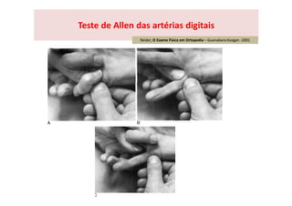Teste de Allen das artérias digitais
Reider, O Exame Físico em Ortopedia – Guanabara Koogan -2001
 