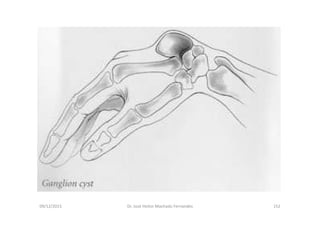 09/12/2015 Dr. José Heitor Machado Fernandes 152
 