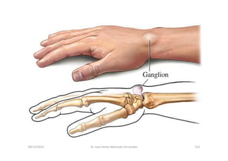 09/12/2015 Dr. José Heitor Machado Fernandes 153
 