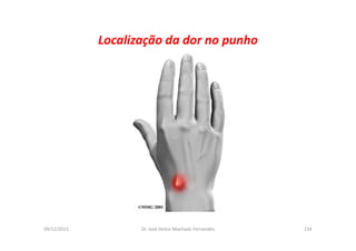 09/12/2015 Dr. José Heitor Machado Fernandes 154
Localização da dor no punho
 