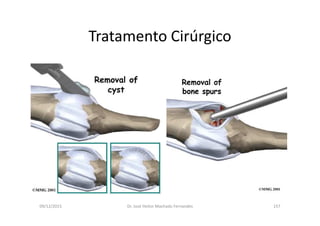 09/12/2015 Dr. José Heitor Machado Fernandes 157
Tratamento Cirúrgico
 