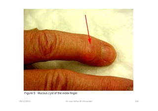 09/12/2015 Dr. José Heitor M. Fernandes 158
 