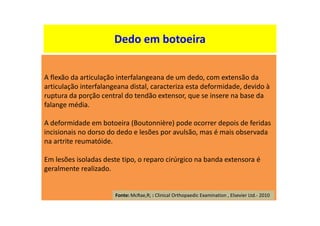Dedo em botoeira
A flexão da articulação interfalangeana de um dedo, com extensão da
articulação interfalangeana distal, caracteriza esta deformidade, devido à
ruptura da porção central do tendão extensor, que se insere na base da
falange média.
A deformidade em botoeira (Boutonnière) pode ocorrer depois de feridas
incisionais no dorso do dedo e lesões por avulsão, mas é mais observada
na artrite reumatóide.
Em lesões isoladas deste tipo, o reparo cirúrgico na banda extensora é
geralmente realizado.
Fonte: McRae,R; : Clinical Orthopaedic Examination , Elsevier Ltd.- 2010
 