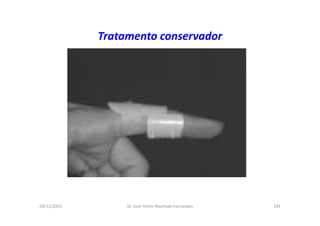 09/12/2015 Dr. José Heitor Machado Fernandes 194
Tratamento conservador
 