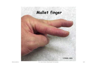 09/12/2015 Dr. José Heitor Machado Fernandes 197
 