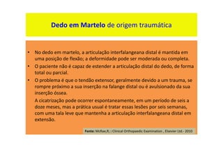 • No dedo em martelo, a articulação interfalangeana distal é mantida em
uma posição de flexão; a deformidade pode ser moderada ou completa.
• O paciente não é capaz de estender a articulação distal do dedo, de forma
total ou parcial.
• O problema é que o tendão extensor, geralmente devido a um trauma, se
rompre próximo a sua inserção na falange distal ou é avulsionado da sua
inserção óssea.
A cicatrização pode ocorrer espontaneamente, em um período de seis a
doze meses, mas a prática usual é tratar essas lesões por seis semanas,
com uma tala leve que mantenha a articulação interfalangeana distal em
extensão.
Dedo em Martelo de origem traumática
Fonte: McRae,R; : Clinical Orthopaedic Examination , Elsevier Ltd.- 2010
 