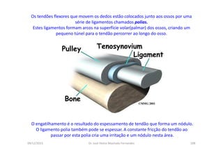 09/12/2015 Dr. José Heitor Machado Fernandes 208
Os tendões flexores que movem os dedos estão colocados junto aos ossos por uma
série de ligamentos chamados polias.
Estes ligamentos formam arcos na superfície volar(palmar) dos ossos, criando um
pequeno túnel para o tendão percorrer ao longo do osso.
O engatilhamento é o resultado do espessamento de tendão que forma um nódulo.
O ligamento polia também pode se espessar. A constante fricção do tendão ao
passar por esta polia cria uma irritação e um nódulo nesta área.
 