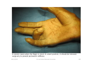 09/12/2015 Dr. José Heitor Machado Fernandes 209
 