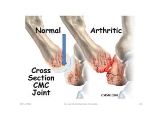 09/12/2015 Dr. José Heitor Machado Fernandes 215
 