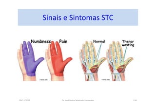 09/12/2015 Dr. José Heitor Machado Fernandes 238
Sinais e Sintomas STC
 