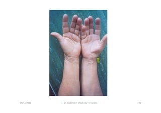 09/12/2015 Dr. José Heitor Machado Fernandes 240
 