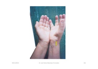 09/12/2015 Dr. José Heitor Machado Fernandes 241
 