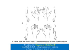 Procedimento = Diagrama de mão de Katz (3)
Condição Detectada = Integridade do nervo mediano
(avaliação da síndrome do túnel do carpo)
 