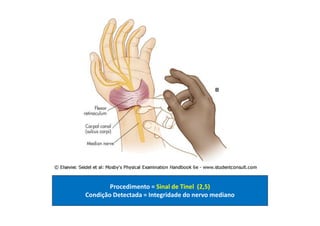 Procedimento = Sinal de Tinel (2,5)
Condição Detectada = Integridade do nervo mediano
 
