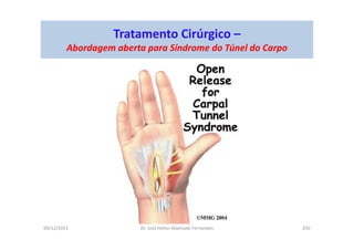 09/12/2015 Dr. José Heitor Machado Fernandes 250
Tratamento Cirúrgico –
Abordagem aberta para Síndrome do Túnel do Carpo
 