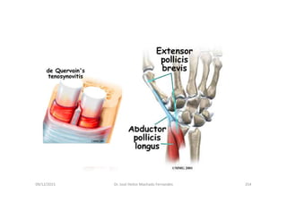 09/12/2015 Dr. José Heitor Machado Fernandes 254
 