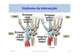 09/12/2015 Dr. José Heitor Machado Fernandes 259
Síndrome da intersecção
ERCC
ERLC
ECP
ALP
 