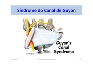 09/12/2015 Dr. José Heitor Machado Fernandes 261
Síndrome do Canal de Guyon
 