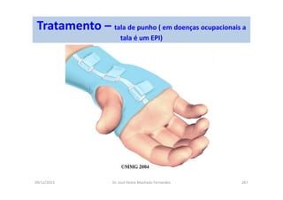 09/12/2015 Dr. José Heitor Machado Fernandes 267
Tratamento – tala de punho ( em doenças ocupacionais a
tala é um EPI)
 