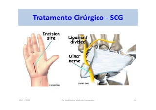 09/12/2015 Dr. José Heitor Machado Fernandes 268
Tratamento Cirúrgico - SCG
 