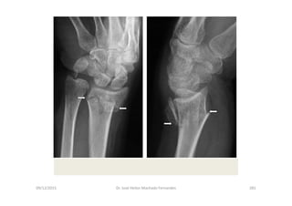 09/12/2015 Dr. José Heitor Machado Fernandes 281
 