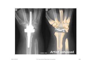figura
09/12/2015 Dr. José Heitor Machado Fernandes 286
 