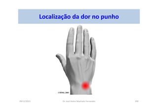 09/12/2015 Dr. José Heitor Machado Fernandes 290
Localização da dor no punho
 