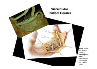 Vínculos dos
Tendões Flexores
Fonte: Mattar
Jr.,R; Azze,RJ;
Falcetti,J;
Semiologia da
Mão –
Publicação do
IOT – Famed
USP , Searle -
Phizer
 