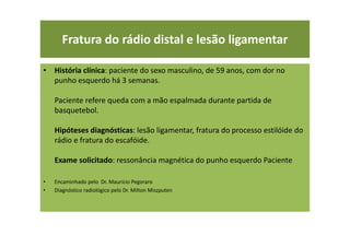 Fratura do rádio distal e lesão ligamentar
• História clínica: paciente do sexo masculino, de 59 anos, com dor no
punho esquerdo há 3 semanas.
Paciente refere queda com a mão espalmada durante partida de
basquetebol.
Hipóteses diagnósticas: lesão ligamentar, fratura do processo estilóide do
rádio e fratura do escafóide.
Exame solicitado: ressonância magnética do punho esquerdo Paciente
• Encaminhado pelo Dr. Maurício Pegoraro
• Diagnóstico radiológico pelo Dr. Milton Miszputen
 