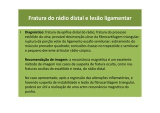 • Diagnóstico: fratura da epífise distal do rádio; fratura do processo
estilóide da ulna; provável desinserção ulnar da fibrocartilagem triangular;
ruptura da porção volar do ligamento escafo-semilunar; estiramento do
músculo pronador quadrado; contusões ósseas no trapezóide e semilunar
e pequeno derrame articular rádio-cárpico.
Recomendação de imagem: a ressonância magnética é um excelente
método de imagem nos casos de suspeita de fratura oculta, como nas
fraturas ocultas do escafóide e nesta, do rádio distal.
No caso apresentado, após a regressão das alterações inflamatórias, e
havendo suspeita de instabilidade e lesão da fibrocartilagem triangular,
poderá ser útil a realização de uma artro-ressonância magnética do
punho.
Fratura do rádio distal e lesão ligamentar
 