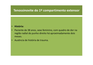 Tenossinovite do 1º compartimento extensor
• História:
• Paciente de 38 anos, sexo feminino, com quadro de dor na
região radial do punho direito há aproximadamente dois
meses.
• Ausência de história de trauma.
 