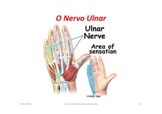 09/12/2015 Dr. José Heitor Machado Fernandes 44
O Nervo Ulnar
 