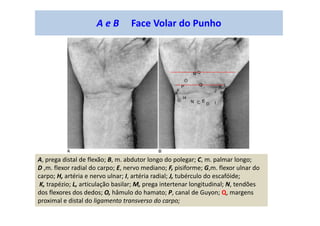 A e B Face Volar do Punho
A, prega distal de flexão; B, m. abdutor longo do polegar; C, m. palmar longo;
D ,m. flexor radial do carpo; E, nervo mediano; F, pisiforme; G,m. flexor ulnar do
carpo; H, artéria e nervo ulnar; I, artéria radial; J, tubérculo do escafóide;
K, trapézio; L, articulação basilar; M, prega intertenar longitudinal; N, tendões
dos flexores dos dedos; O, hâmulo do hamato; P, canal de Guyon; Q, margens
proximal e distal do ligamento transverso do carpo;
 