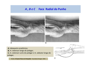 A , B e C Face Radial do Punho
A, tabaqueira anatômica;
B, m. extensor longo do polegar;
C, m. extensor curto do polegar e m. abdutor longo do
polegar;
Reider, O Exame Físico em Ortopedia – Guanabara Koogan -2001
 