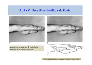A , B e C Face Ulnar da Mão e do Punho
A, quinto metacarpo; B, eminência
hipotenar; C, cabeça da ulna;
Reider, O Exame Físico em Ortopedia – Guanabara Koogan -2001
 