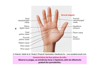 Características da face palmar da mão.
Observe as pregas, as eminências tenar e hipotenar, além do afilamento
gradual dos quirodáctilos.
Terra de ninguém
 