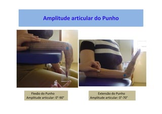 Amplitude articular do Punho
Flexão do Punho
Amplitude articular: 0°-90°
Extensão do Punho
Amplitude articular: 0°-70°
 