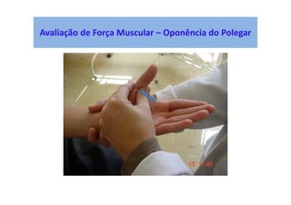 Avaliação de Força Muscular – Oponência do Polegar
 