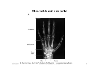 09/12/2015 Dr. José Heitor Machado Fernandes 9
RX normal da mão e do punho
 