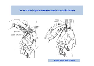 O Canal de Guyon contém o nervo e a artéria ulnar
Palpação da artéria ulnar.
 