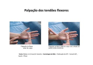 Palpação dos tendões flexores
Fonte: Mattar Jr.,R; Azze,RJ; Falcetti,J; Semiologia da Mão – Publicação do IOT – Famed USP ,
Searle - Phizer
 