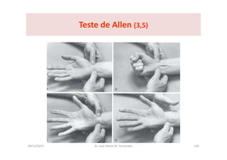 09/12/2015 Dr. José Heitor M. Fernandes 130
Teste de Allen (3,5)
 