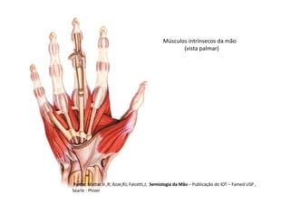 Músculos intrínsecos da mão
(vista palmar)
Fonte: Mattar Jr.,R; Azze,RJ; Falcetti,J; Semiologia da Mão – Publicação do IOT – Famed USP ,
Searle - Phizer
 