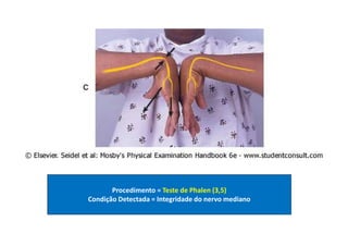 Procedimento = Teste de Phalen (3,5)
Condição Detectada = Integridade do nervo mediano
 