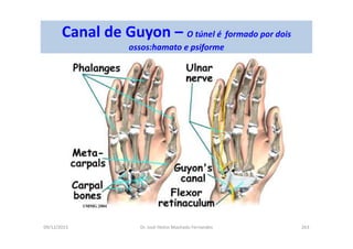09/12/2015 Dr. José Heitor Machado Fernandes 263
Canal de Guyon – O túnel é formado por dois
ossos:hamato e psiforme
 