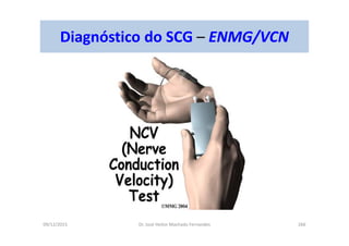 09/12/2015 Dr. José Heitor Machado Fernandes 266
Diagnóstico do SCG – ENMG/VCN
 